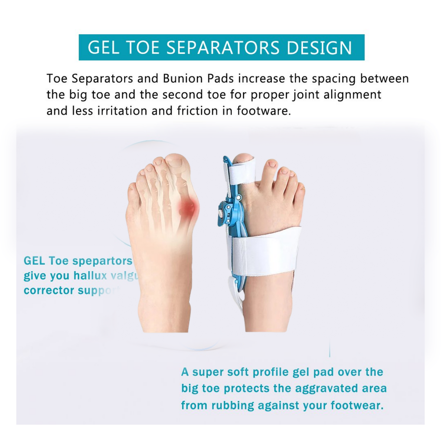 Adjustable Bunion Support Splint – Hallux Valgus Corrector for Men & Women